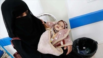 DSÖ: Yemenli evlatların yüzdelik 75'i ehliyetsiz beslenmeden muzdarip