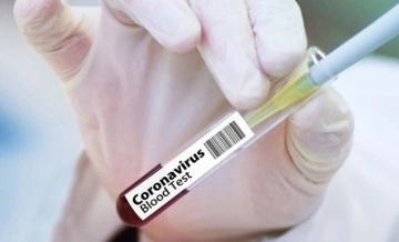 Ekvador Covid-19’a karşı zorunlu aşı kararı aldı