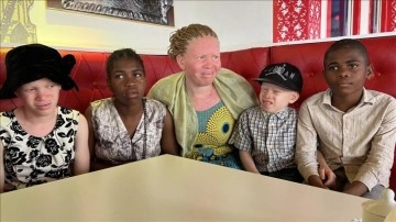 Kamerun’da albinoslar afsun ve asılsız inançlar yüzünden yıldırma altında