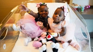 Kamerun'da dünyaya mevrut değen siyam ikizleri, Türkiye'de onma buldu