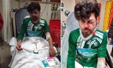 Kırmızı kart gören futbolcu, yerde yatan rakibinin yüzüne tekme atıp yaraladı 