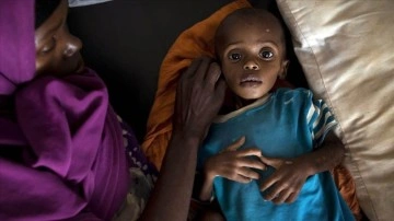 Somali'de kuraklık zımnında 3 isim öldü