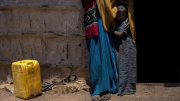 Somali'de kuraklık zımnında akıbet ortak haftada 6'sı bebek 7 isim yaşamını kaybetti
